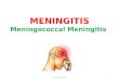 Meningitis Meningococcal Meningitis