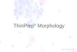 Thin prep morphology (Cervical cytology)