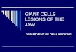Peripheral giant cell granuloma (giant cell epulis