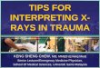 Tips for interpreting x ray in trauma