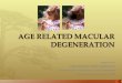 Age related macular degeneration from Optometrist Point of View
