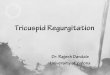 Tricuspid regurgitation and echocardiography