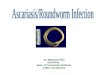 Ascariasis/Roundworm Inf