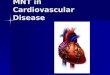 Cvd prevalence, risk, and pathophysiology