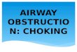 Airway obstruction: CHOKING
