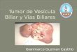 Tumor de vesícula biliar y vías biliares