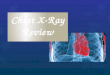 Chest x ray review