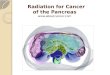 Radiation Therapy for Pancreas Cancer