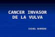 Cancer invasor de la vulva
