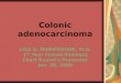 Colonic Adenocarcinoma