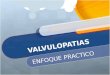 Valvulopatias Medicina Interna Enfoque Practico