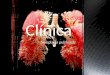 Clínica Neoplasia pulmonar