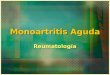 Monoartritis Aguda