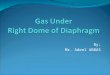 Gas Under Diaphragm - Final Year MB BS Lecture
