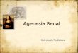 Agenesia renal