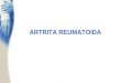 artrita reumatoida diagnostic
