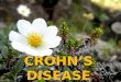 CROHN’S DISEASE presentasi
