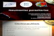 Neumonías parasitarias