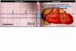 La alegría de leer el electrocardiograma 2da Edición