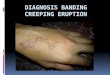 Diagnosis Banding CE