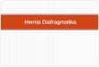 CSS Hernia Diafragmatika Iman