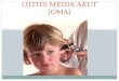 Otitis-Media-Akut B.AJAR.ppt