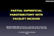 PARTIAL SUPERFICIAL PAROTIDECTOMY WITH FACELIFT INCISION. IPRAS