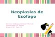 Neoplasias de esofago
