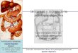 Tema 32 Pg SíNtomas Y Signos De La PatologíA Digestiva