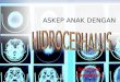 Askep anak hydrocephalus3 (hidrosefalus)