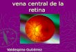 ObstruccióN De La Vena Central De La Retina