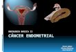 Cancer de endometrio/Cancer de Ovario