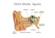 Otitis Media Aguda (OMA)
