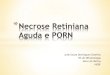 Necrose retiniana aguda e porn
