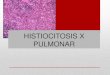 Histiocitosis x final