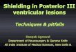 Sheilding in posterior third ventricular tumors