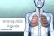 Bronquitis aguda (introducción al tema)