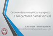 Carcinoma temprano glótico y supraglótico, laringectomia