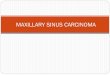 Maxillary sinus carcinoma