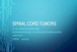 Spinal cord tumors