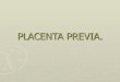 Placenta Previa Y Dppni