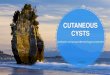 Cutaneous Cysts