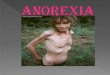 Anorexiako powert point a blogerako