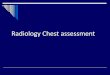 Radiology chest assessment