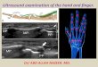 Presentation1.pptx, ultrasound of the hand and fingers