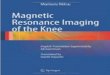 Niitsu   magnetic resonance imaging of the knee