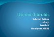 Uterine fibroids by Dr sehrish fatima