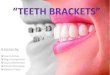 Teeth brackets