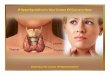 Hypothyroidism a general_overview