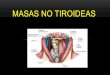 Masas no tiroideas